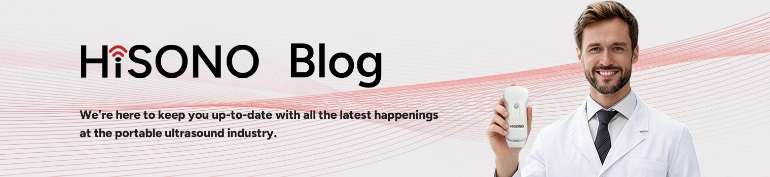 HiSONO Banner
